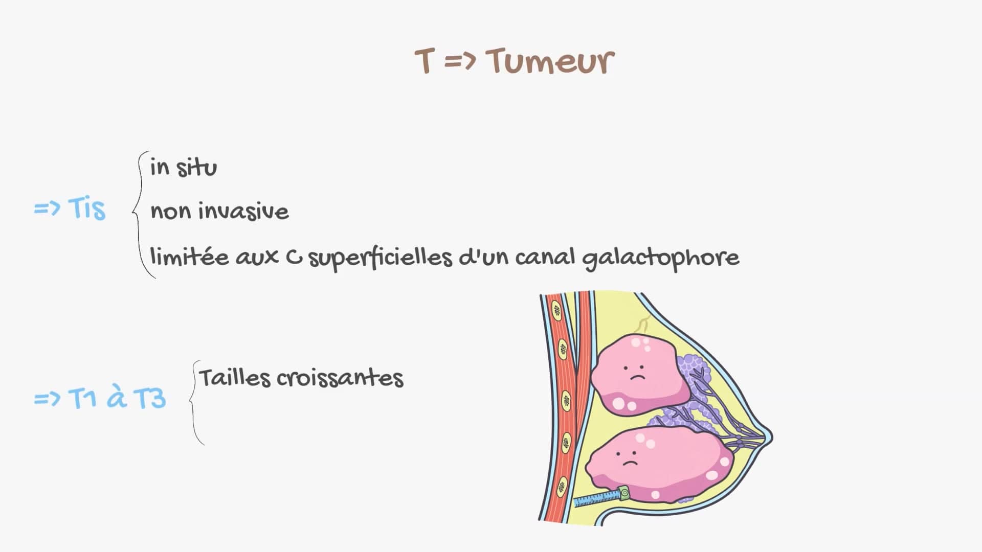 Pronostic et classification TNM du cancer du sein