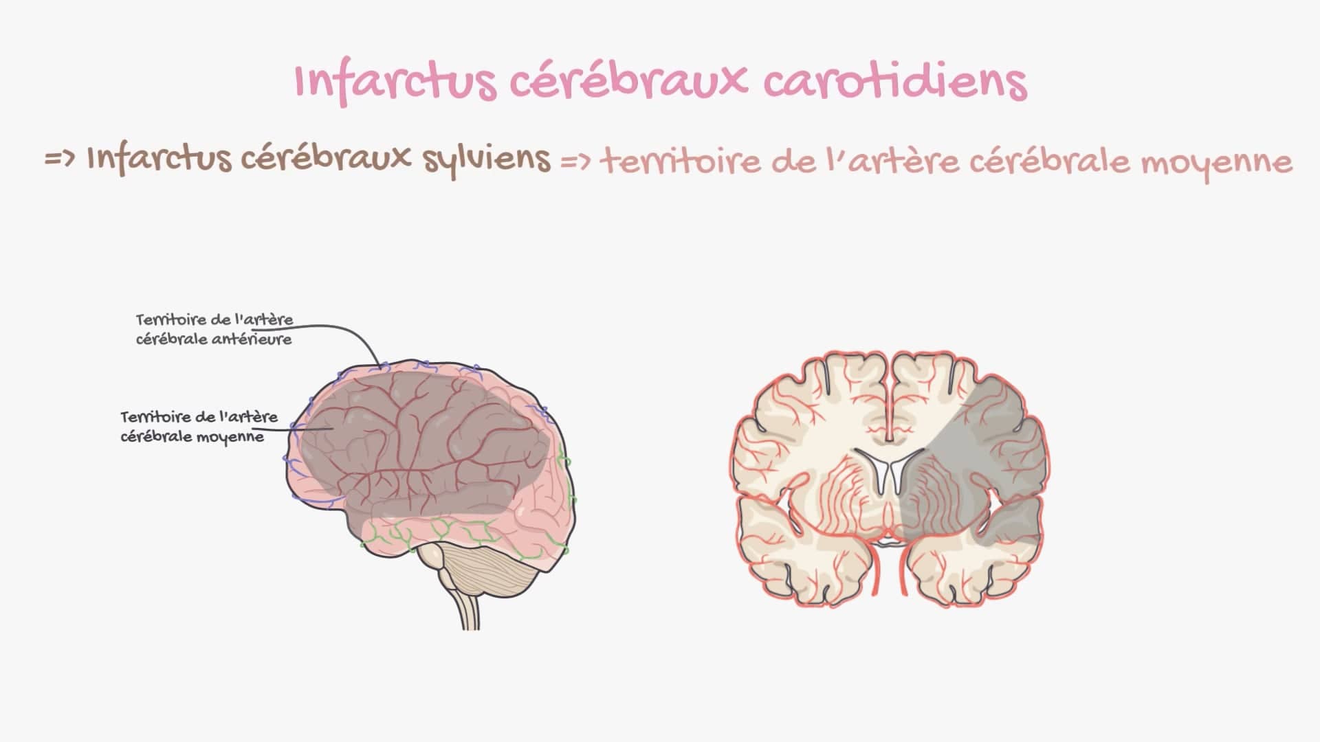 Diagnostic topographique de l’AVC ischémique et AIT