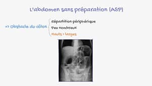 La radiologie du tube digestif
