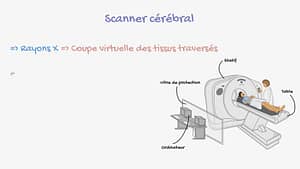 Neuroradiologie
