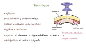 Ponction sternale – Myélogramme