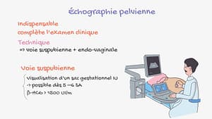 Diagnostic clinique et paraclinique de la GEU